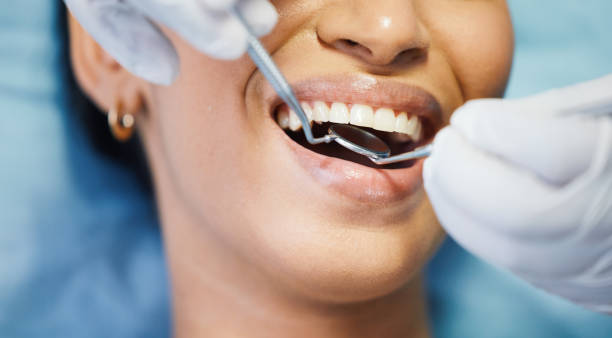 Best Emergency Treatment for Dental Infections or Abscesses in North Utica, IL